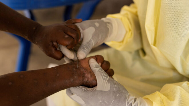 ευλογιά-των-πιθήκων-γιατί-κηρύχθηκε-κ-563173765