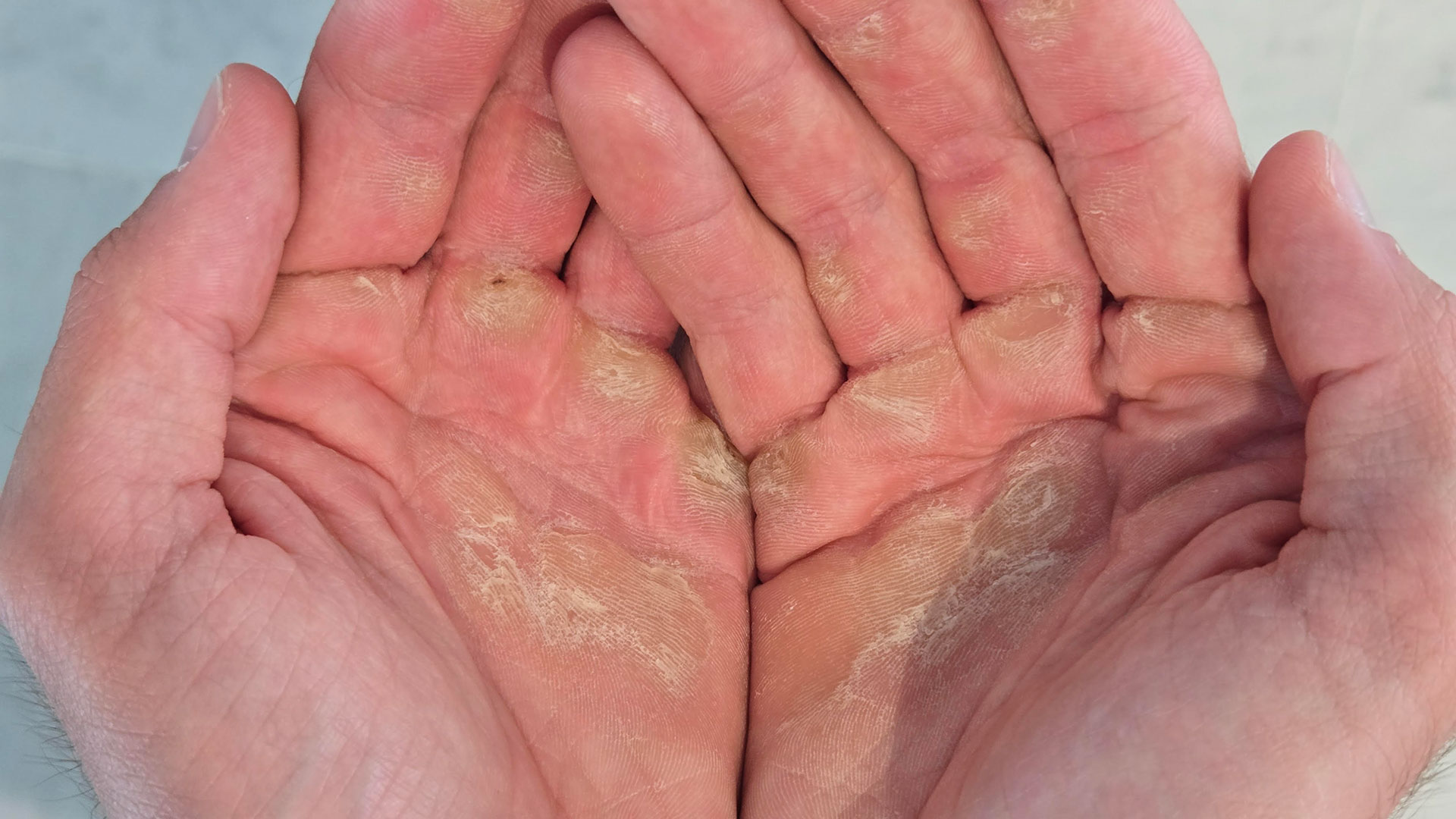 Τα παιδιά με τους ρόζους στα χέρια-1