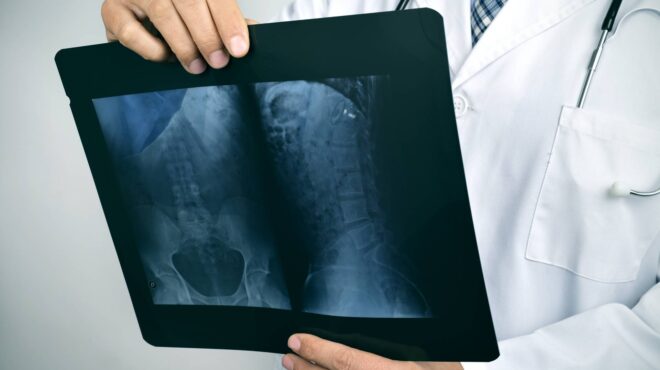 δραματική-αύξηση-17-καρκίνων-στους-νέου-563154403