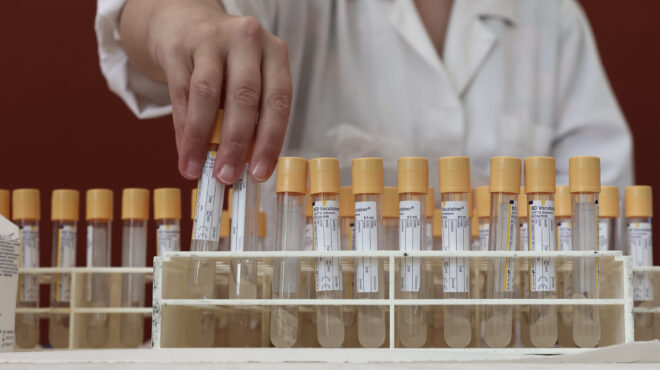 εκεα-κάλεσμα-σε-αιμοδοσία-για-να-καλυφ-563200768