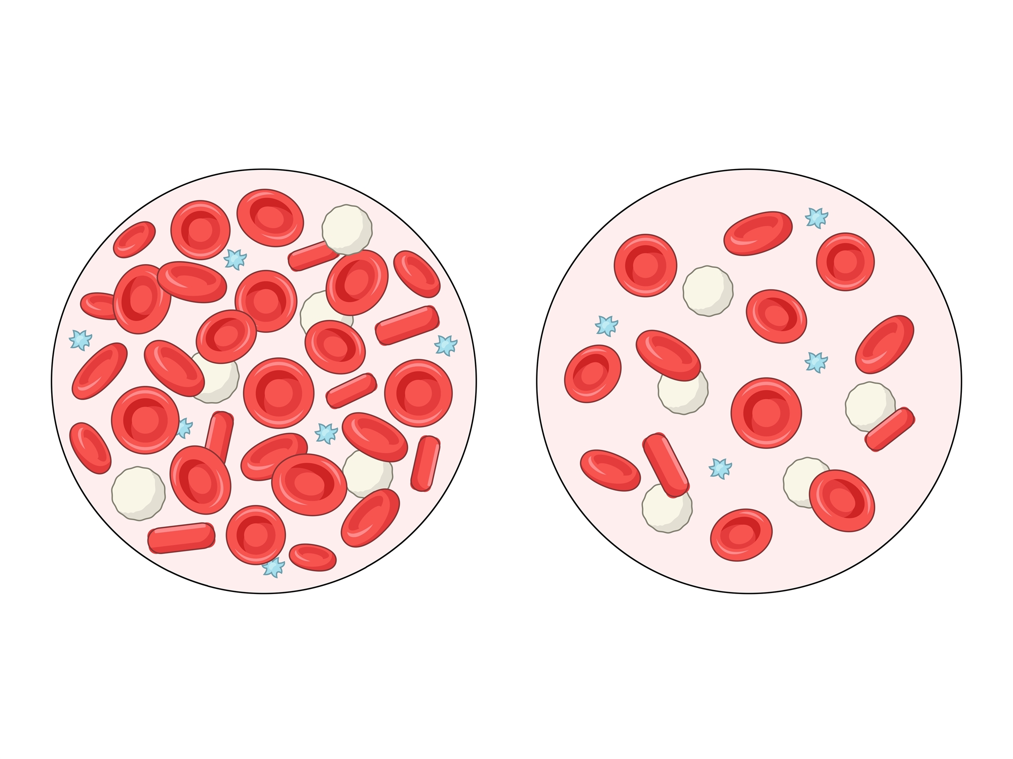 Μήπως σας διαφεύγουν τα ανεπαίσθητα σημάδια της αναιμίας;-2