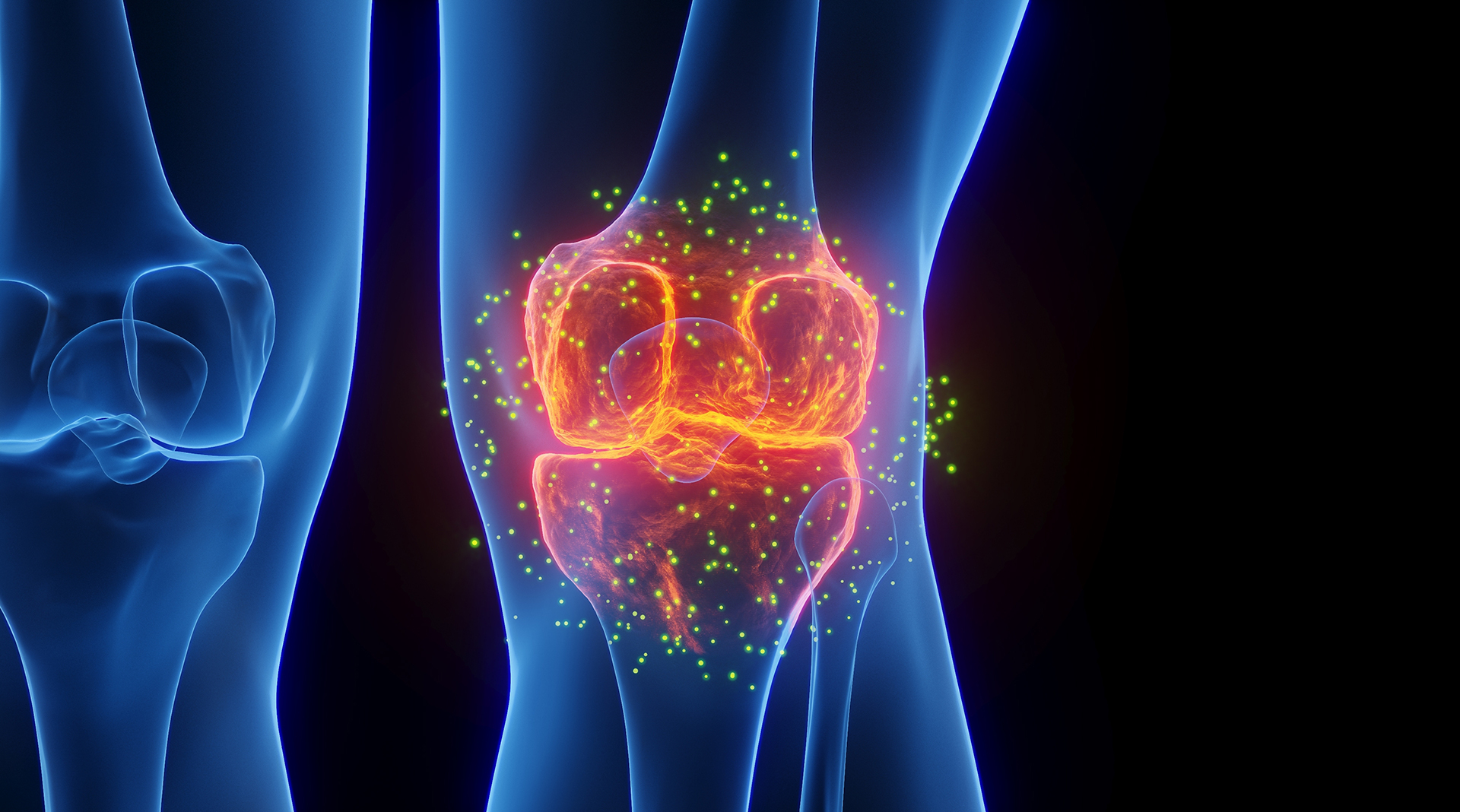 Προβλήματα στην αντιμετώπιση της ρευματοειδούς αρθρίτιδας-1