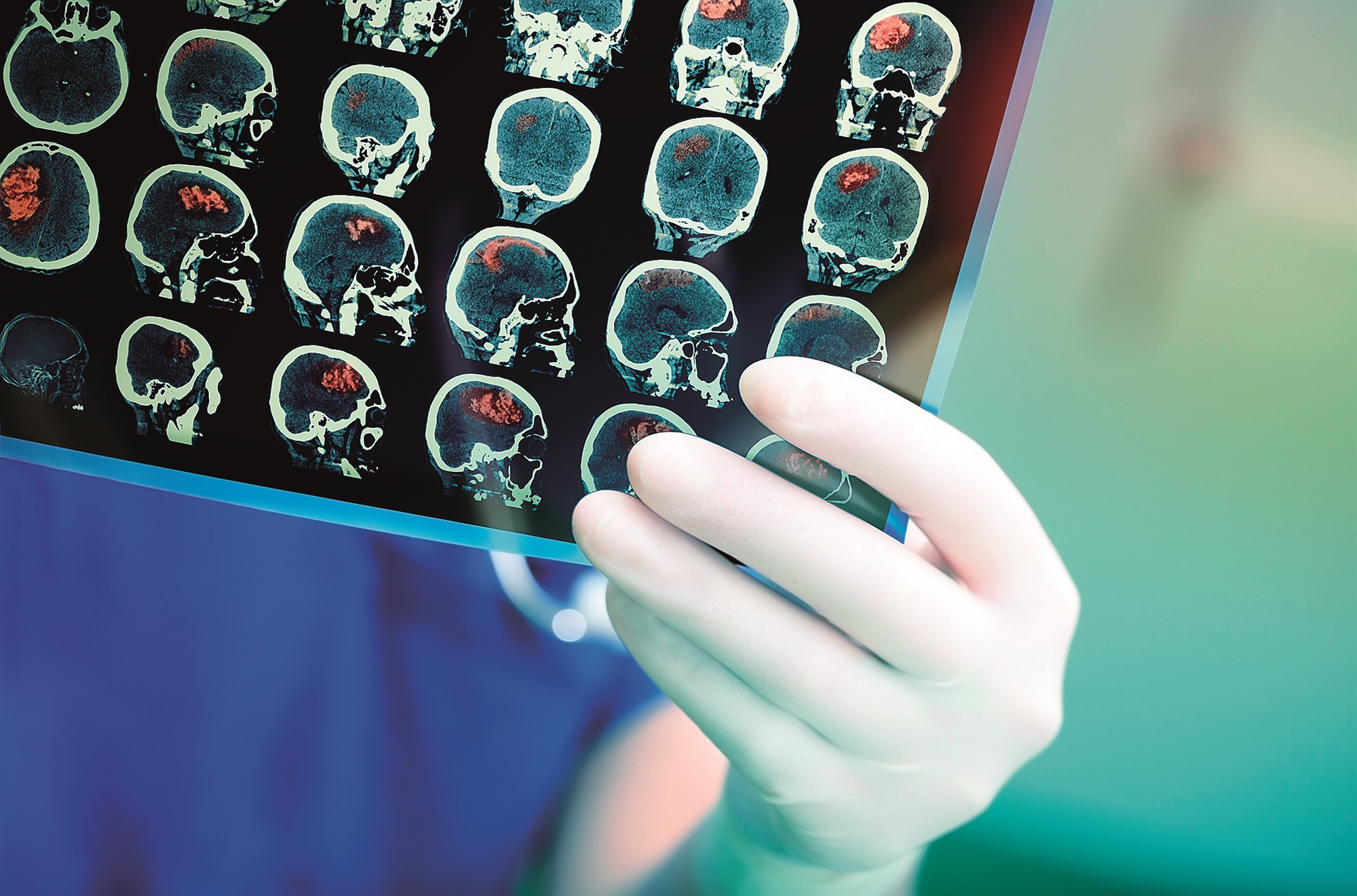 Ο αντίκτυπος της κατάθλιψης στη γνωστική λειτουργία-2