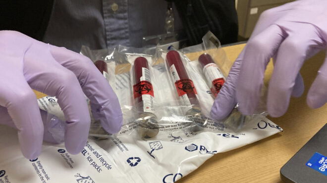 θεσσαλονίκη-οι-βιοψίες-που-χρονίζουν-563343139