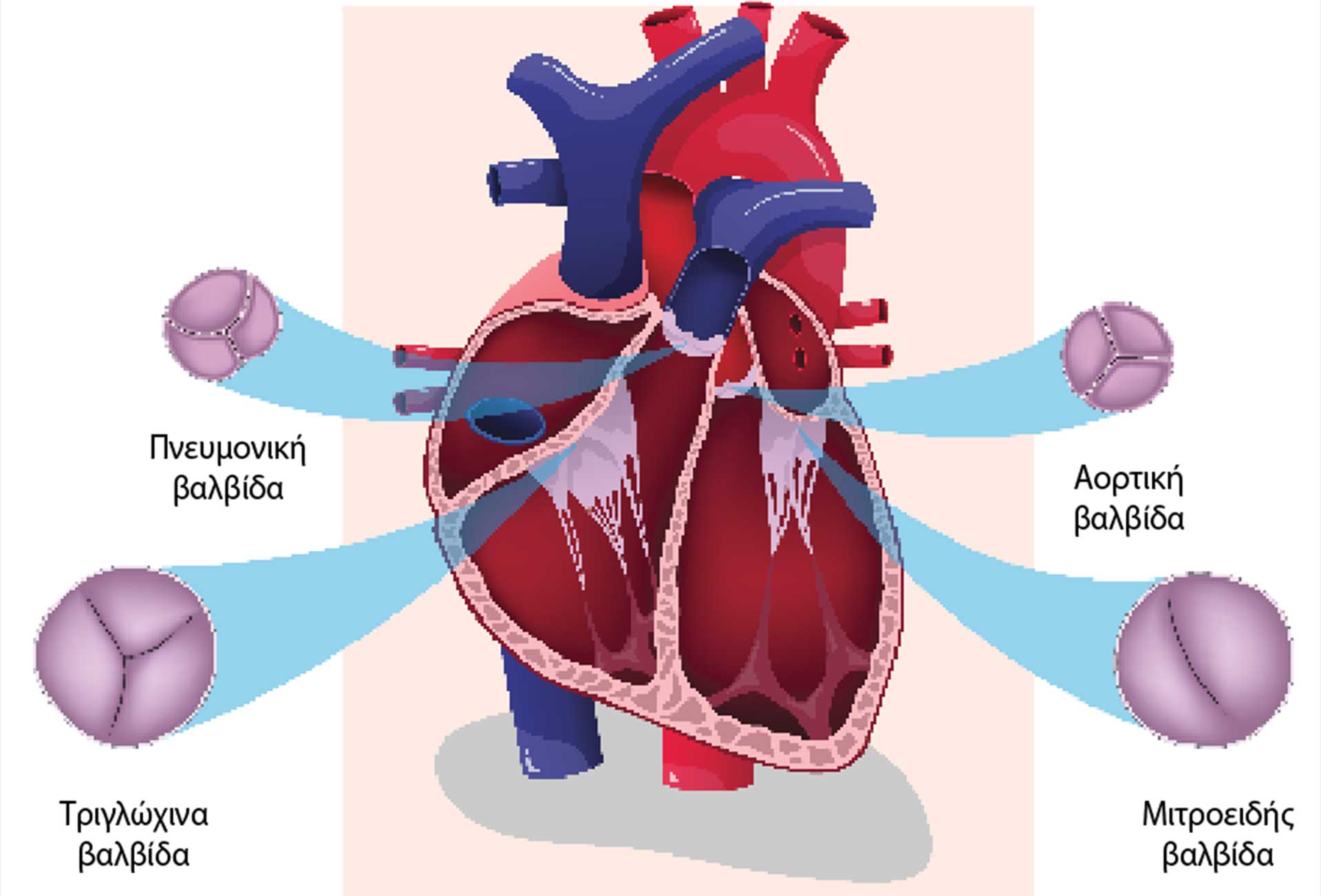 Επιλογές επιδιόρθωσης της ανεπάρκειας της τριγλώχινας βαλβίδας-2