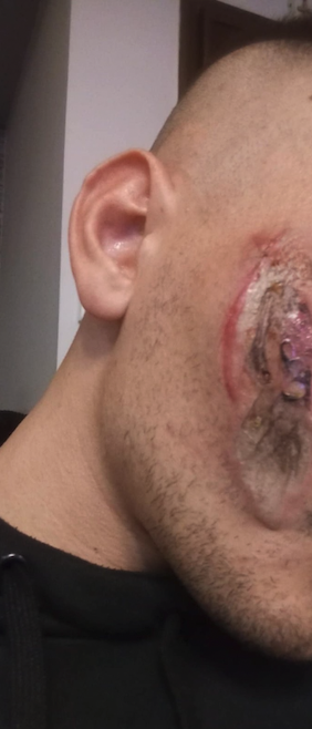 «Το κινητό ανεφλέγη στο μάγουλό μου, είχε φουσκώσει και πετούσε φωτιές»-2