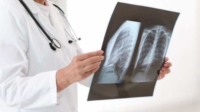 πρόληψη-και-έλεγχος-τα-αποτελεσματικ-563368303