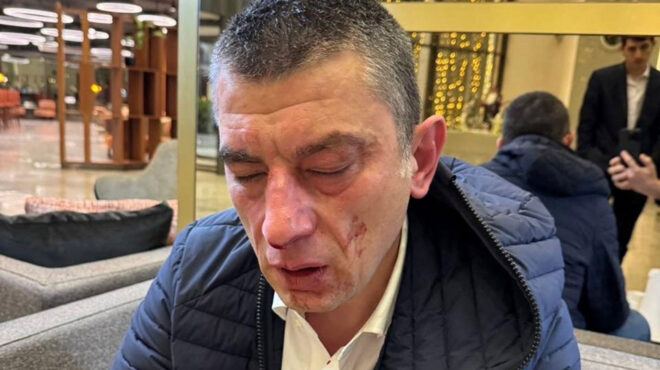 γεωργία-πρώην-πρωθυπουργός-στο-νοσοκ-563418388