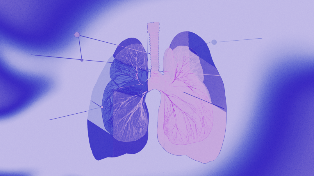 πόσο-εύκολα-μία-ύπουλη-γρίπη-γυρνάει-563416501