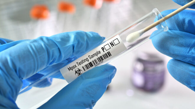 ευλογιά-των-πιθήκων-νέο-κρούσμα-της-πα-563445913