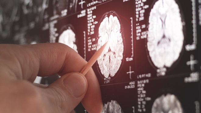 ολο-και-περισσότερα-νανοπλαστικά-σ-563450683