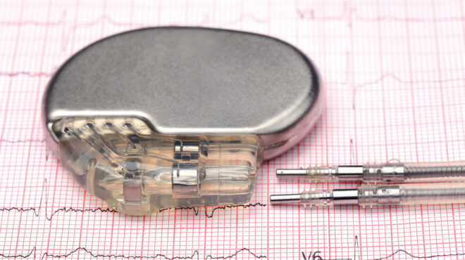 τι-πρέπει-να-γνωρίζετε-για-τις-ανακλήσ-563477197