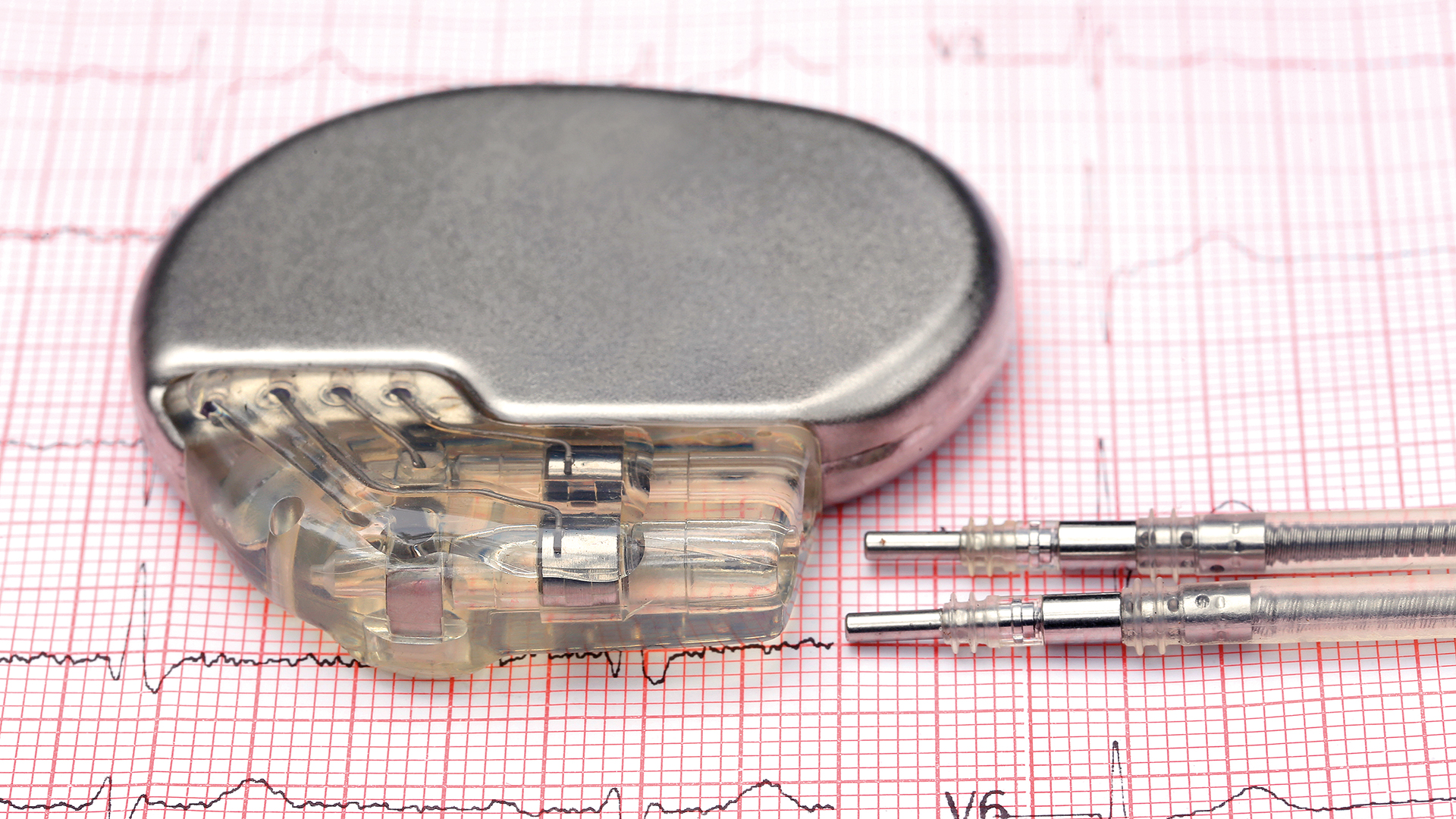 τι-πρέπει-να-γνωρίζετε-για-τις-ανακλήσ-563477197