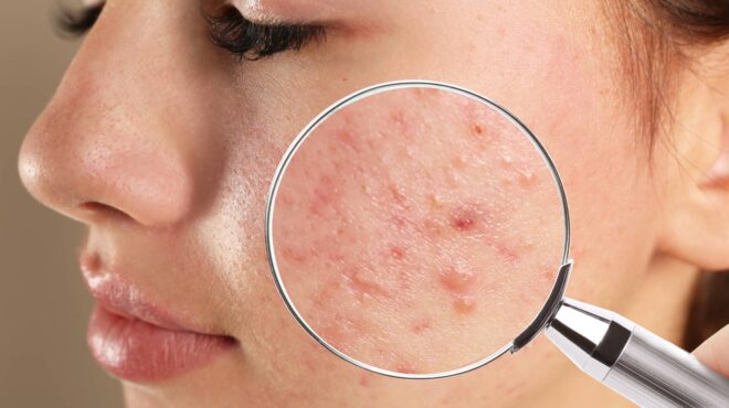 ηπα-ανακαλούνται-γνωστές-κρέμες-για-τ-563512585