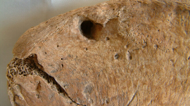 τι-αποκάλυψαν-δαγκωματιές-λιονταριο-563577085