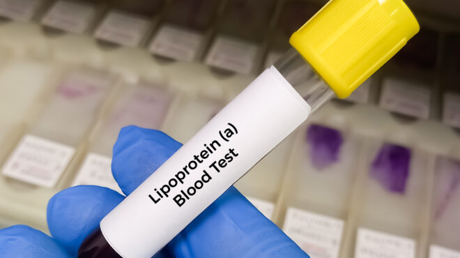 λιποπρωτεΐνη-α-νεότερα-για-τις-εξετάσ-563576965