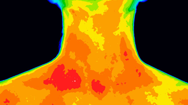 κατανοώντας-τη-φλεγμονή-563559277