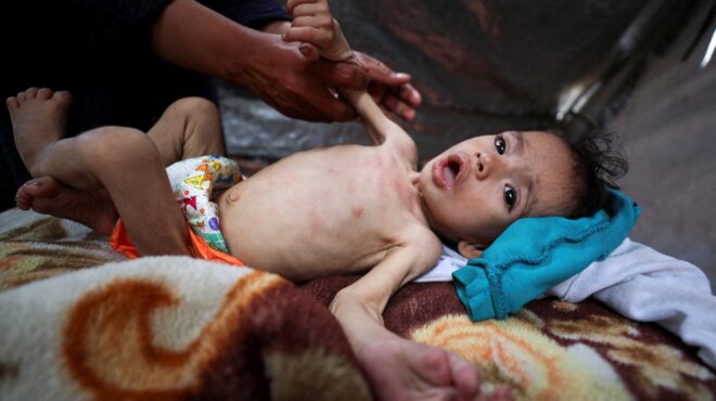 οηε-η-γάζα-είναι-η-πλέον-υποσιτισμένη-563640643