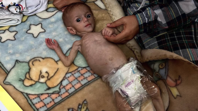 τραμπ-στη-γάζα-πολλοί-λιμοκτονούν-πρέ-563608036