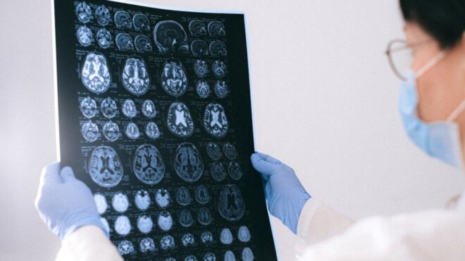 ερευνα-η-καθιστική-ζωή-παράγοντας-κιν-563612146