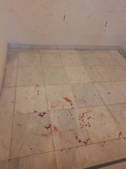 Νομική: Μπήκαν, χτύπησαν, έφυγαν ανενόχλητοι – Η καταδρομική επίθεση και τα κενά ασφαλείας-2