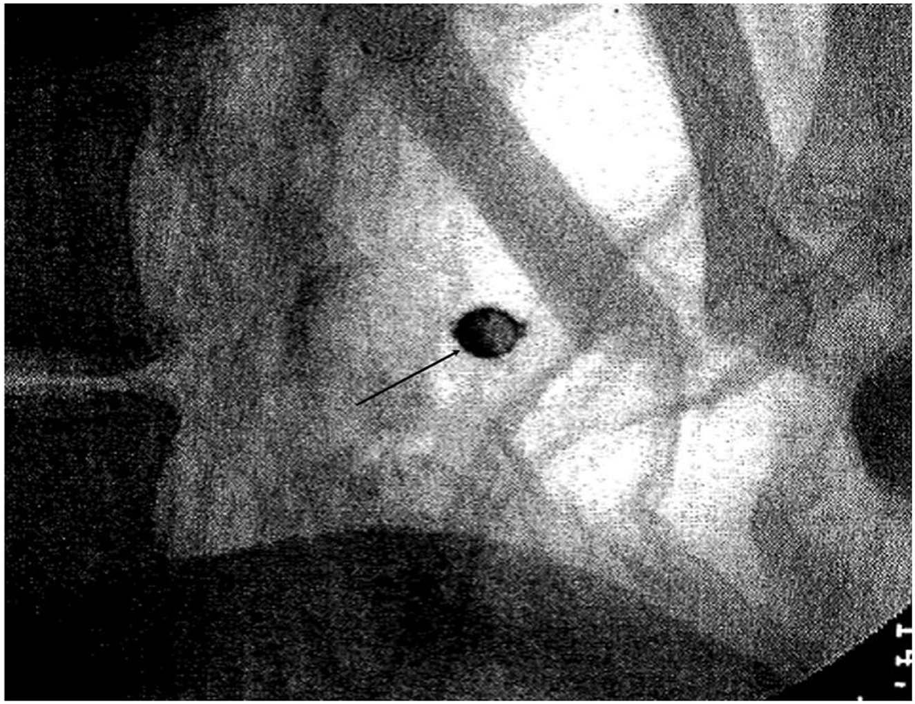 Οι επιστήμονες έλυσαν το μυστήριο της Αλπικής μούμιας-2