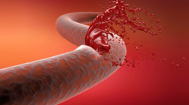 προβλήματα-αιμορραγίας-μάθετε-πόσο-κ-563620021