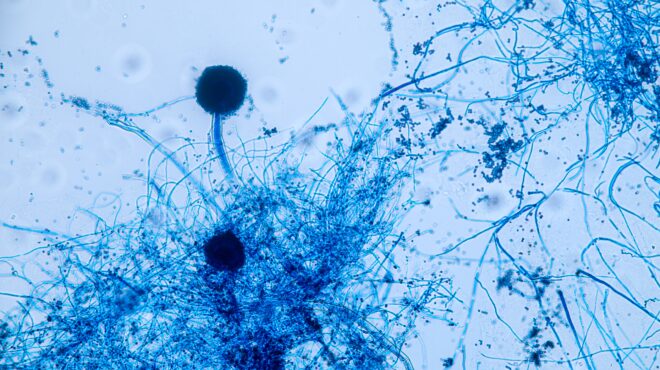 ενας-μύκητας-που-μας-τρώει-από-μέσα-η-563632015