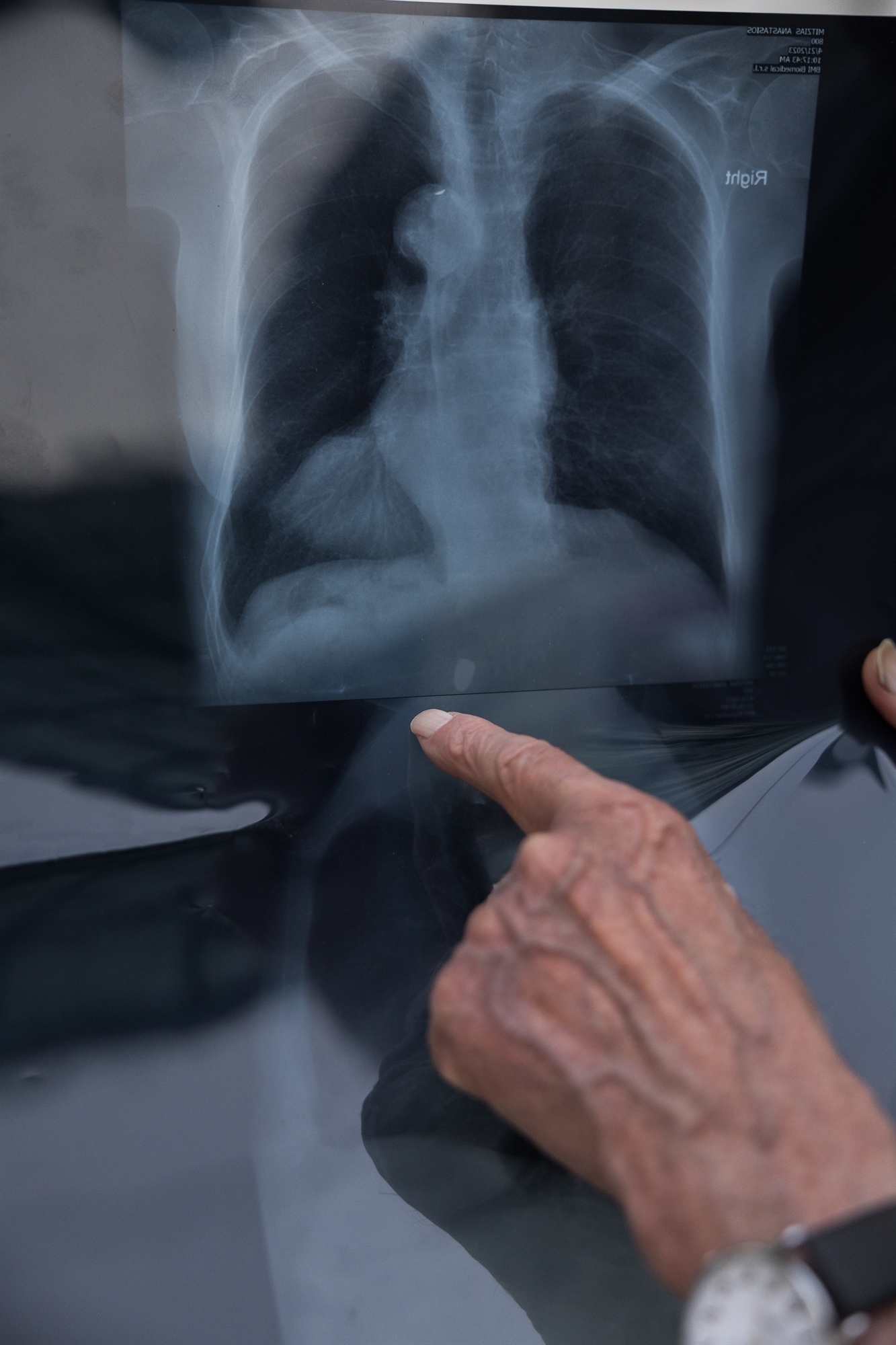 Ζούμε μαζί 80 χρόνια εγώ και η σφαίρα-1