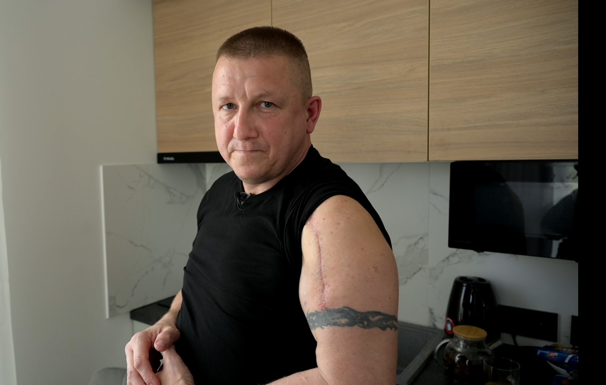 «Τους είναι πιο εύκολο να μας ακρωτηριάζουν»-1