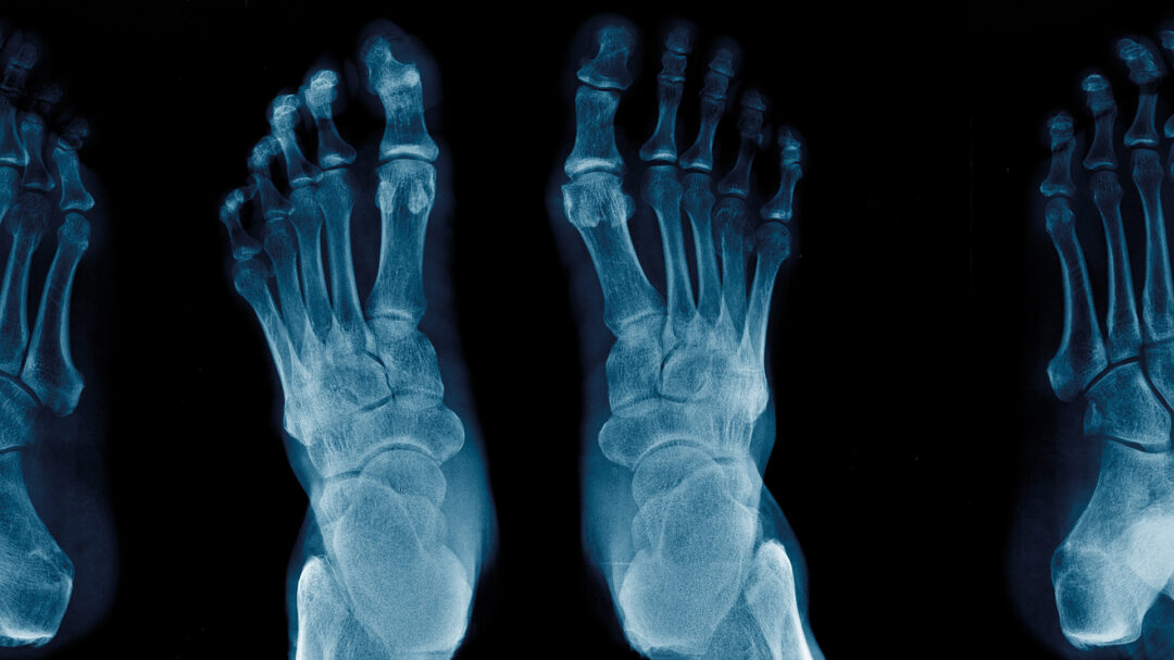 χρειάζεστε-πράγματι-χειρουργείο-για-563667349