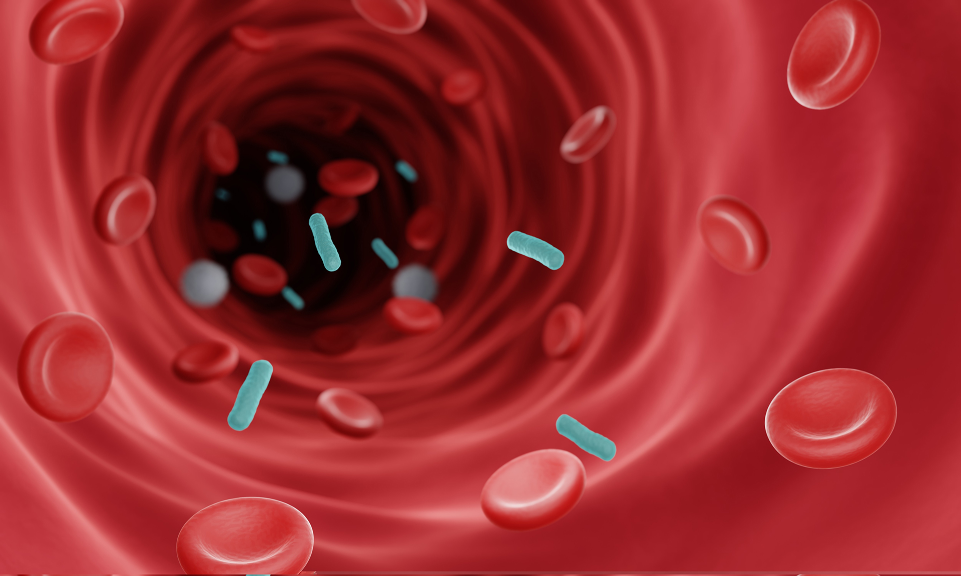 Σταματώντας τη σήψη εν τη γενέσει της-1