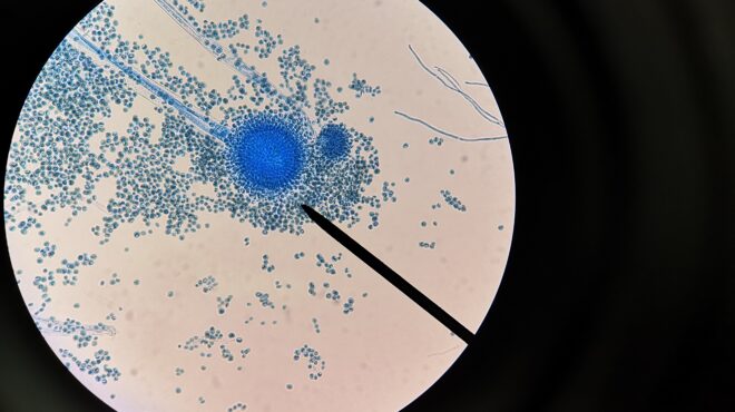 o-μύκητας-της-κατάρας-των-φαραώ-στη-μά-563678959