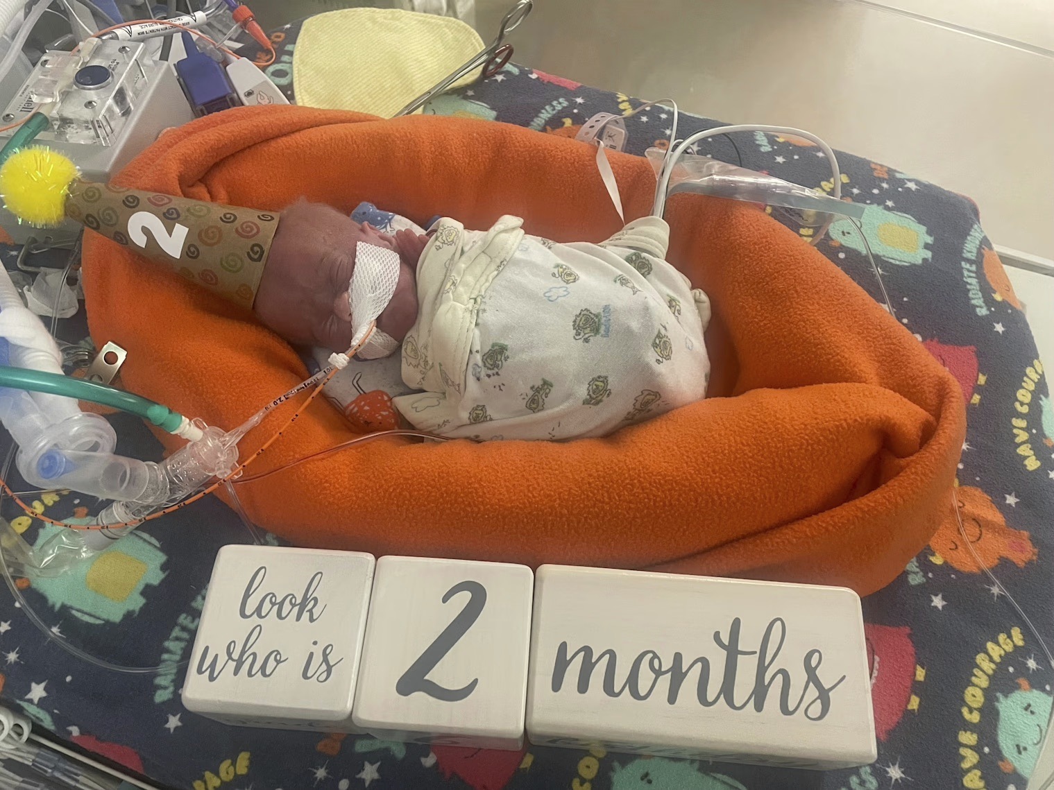 Το πιο πρόωρο μωρό του κόσμου γιορτάζει τα πρώτα του γενέθλια-3