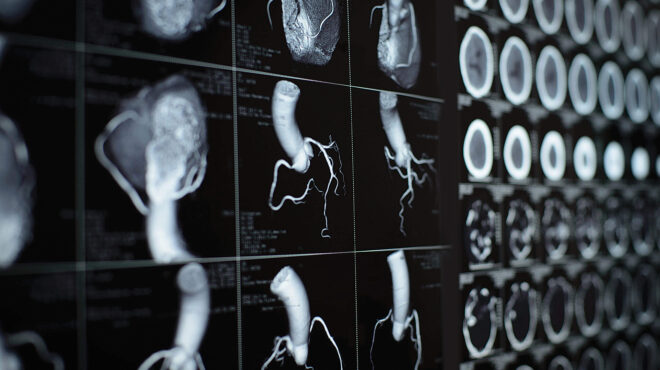συνταγή-για-γερή-καρδιά-με-πολλαπλά-οφ-563694472