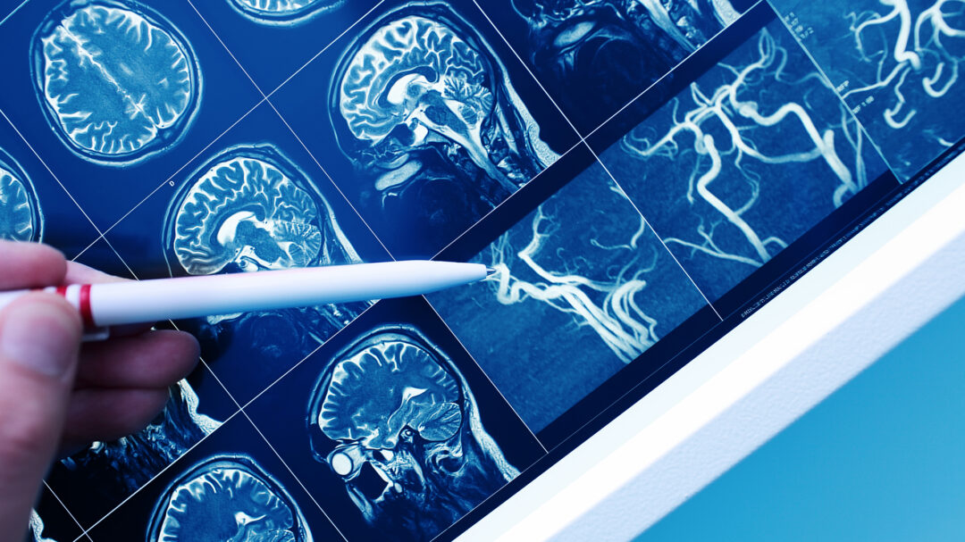 ελεγχος-για-άνοια-563738878