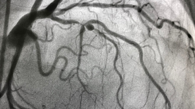 παρατηρώντας-τις-στεφανιαίες-αρτηρί-563701978