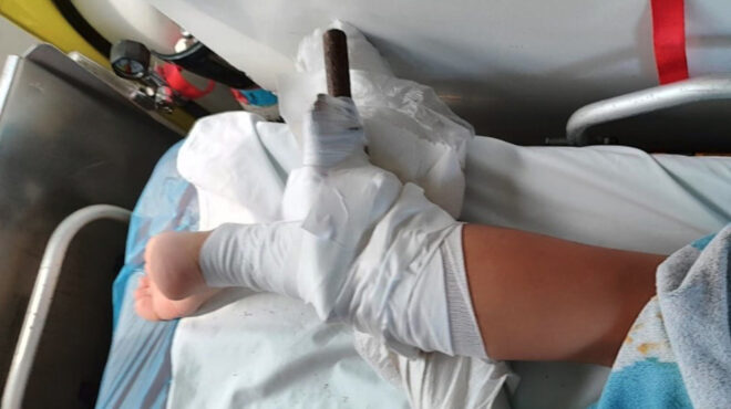 χαλκιδική-ομπρέλα-θαλάσσης-σφηνώθηκ-563755738