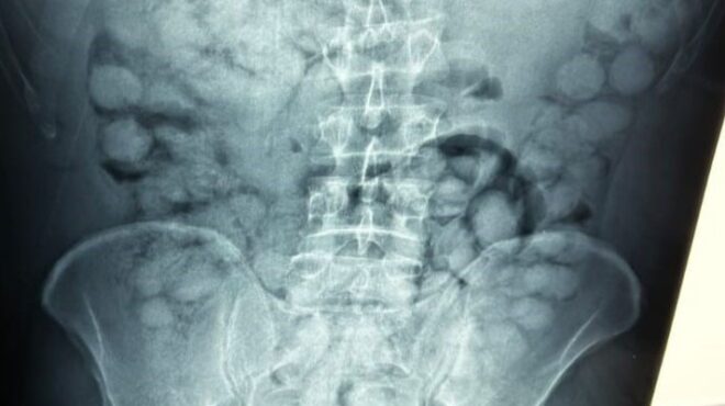 ελ-βενιζέλος-συνελήφθη-άνδρας-που-ε-563768449