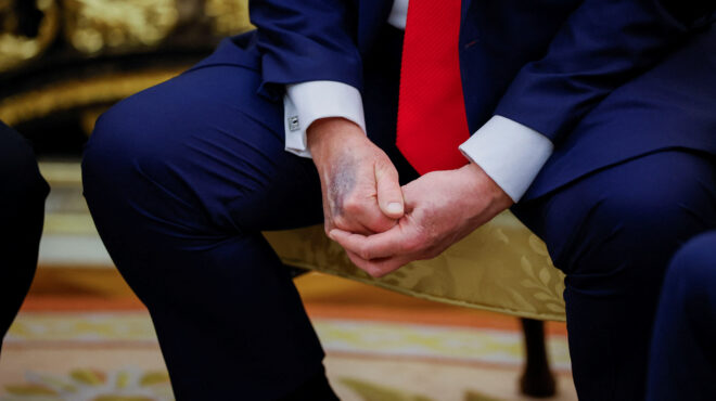 ερωτήματα-για-την-υγεία-του-τραμπ-μετά-563779564