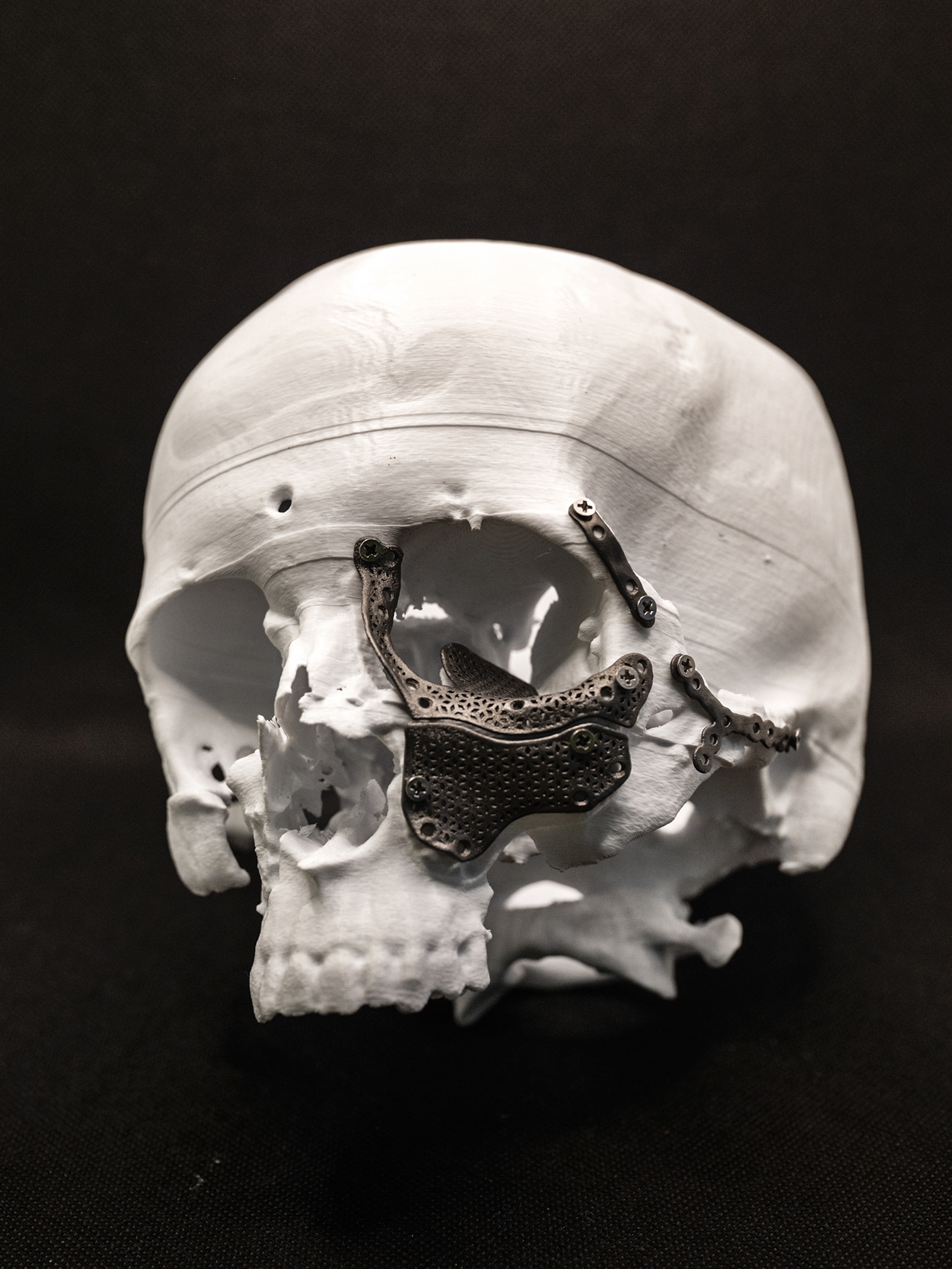 Δίνοντας ξανά πρόσωπο στα «φαντάσματα»-3