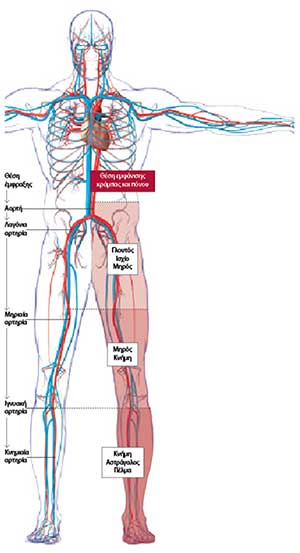 Περιφερική αρτηριοπάθεια: Νεότερα δεδομένα-1