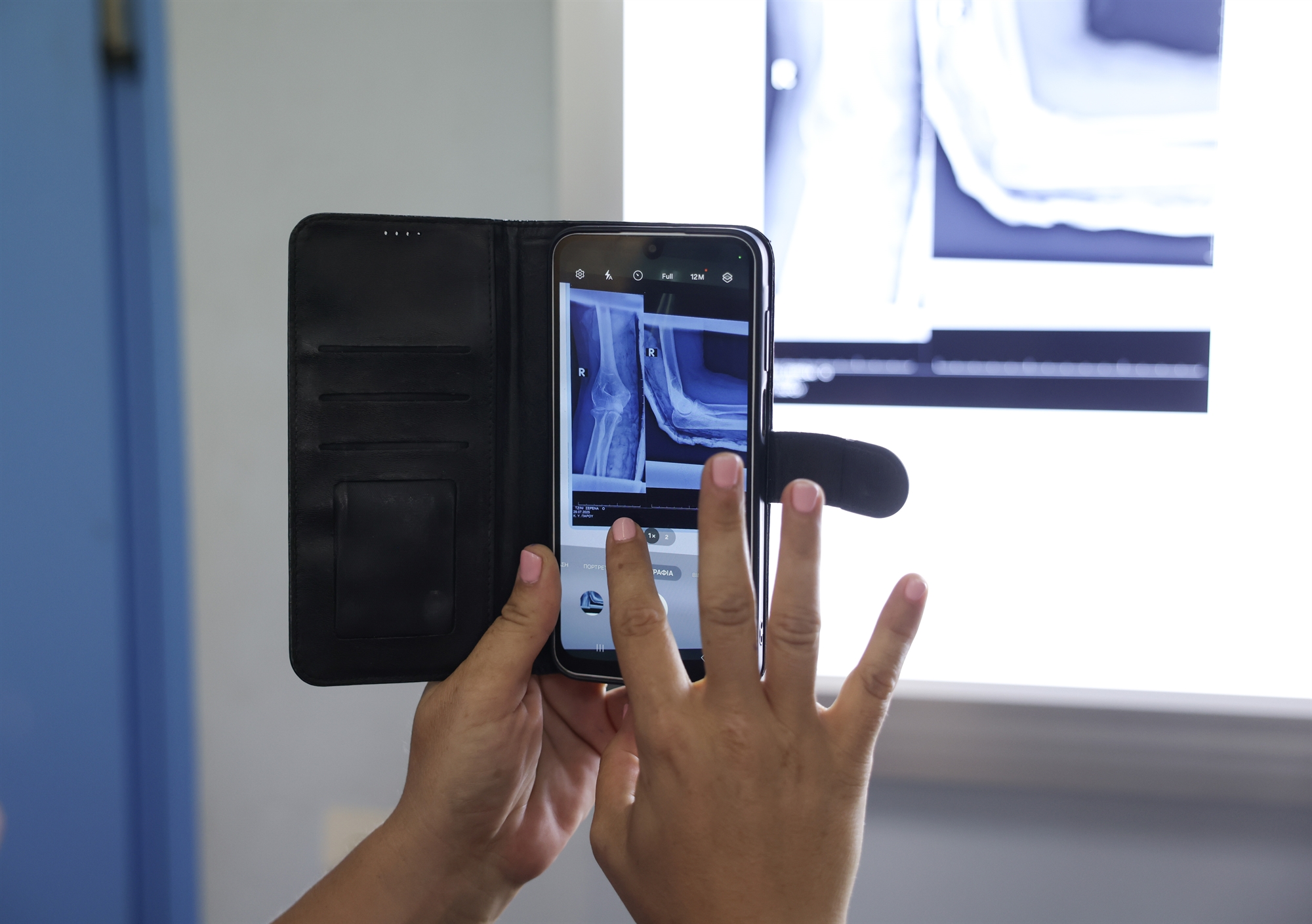 Ο πυρετός μιας εφημερίας στην Πάρο-4