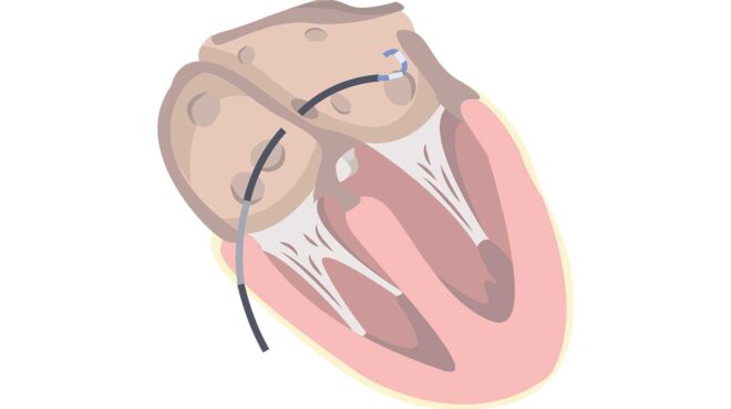 μια-ταχύτερη-ασφαλέστερη-θεραπεία-γι-563752570