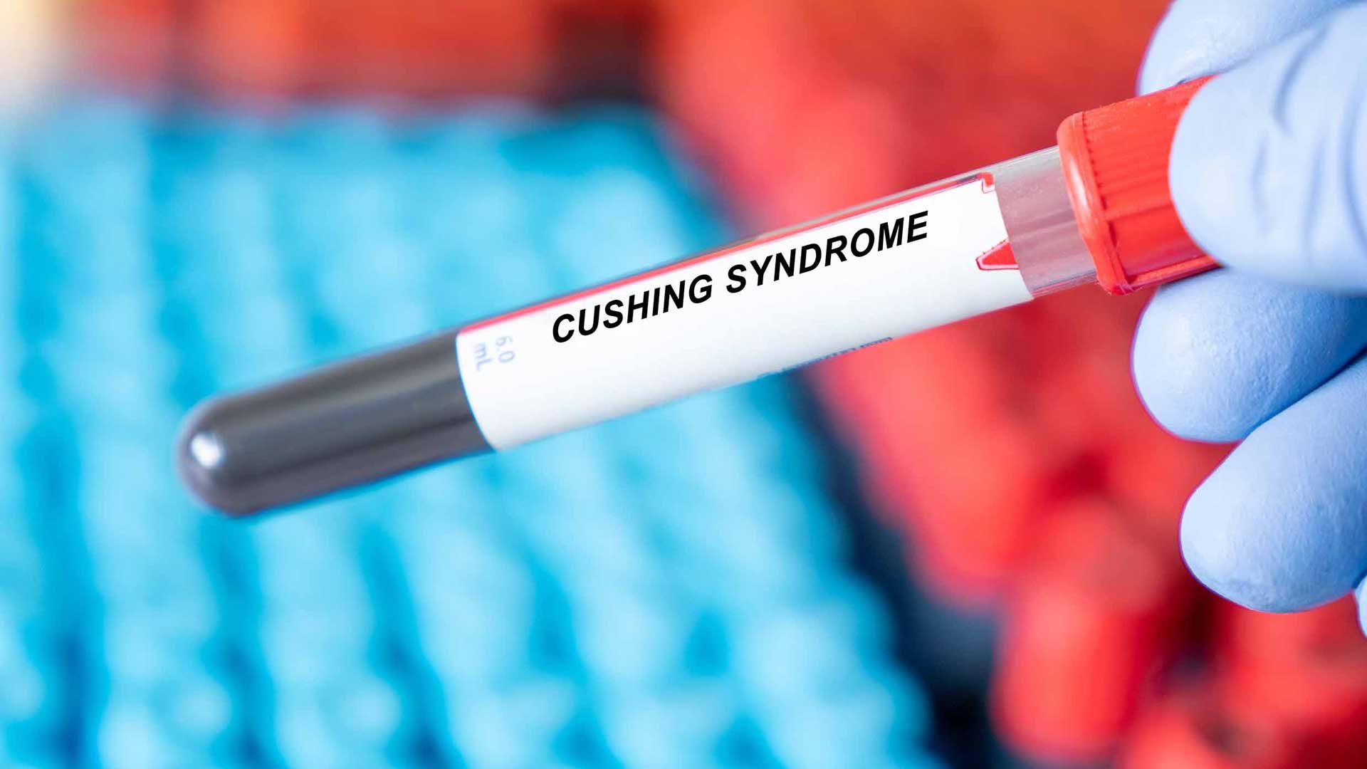 σύνδρομο-cushing-εξπέρ-στη-μεταμφίεση-563762875