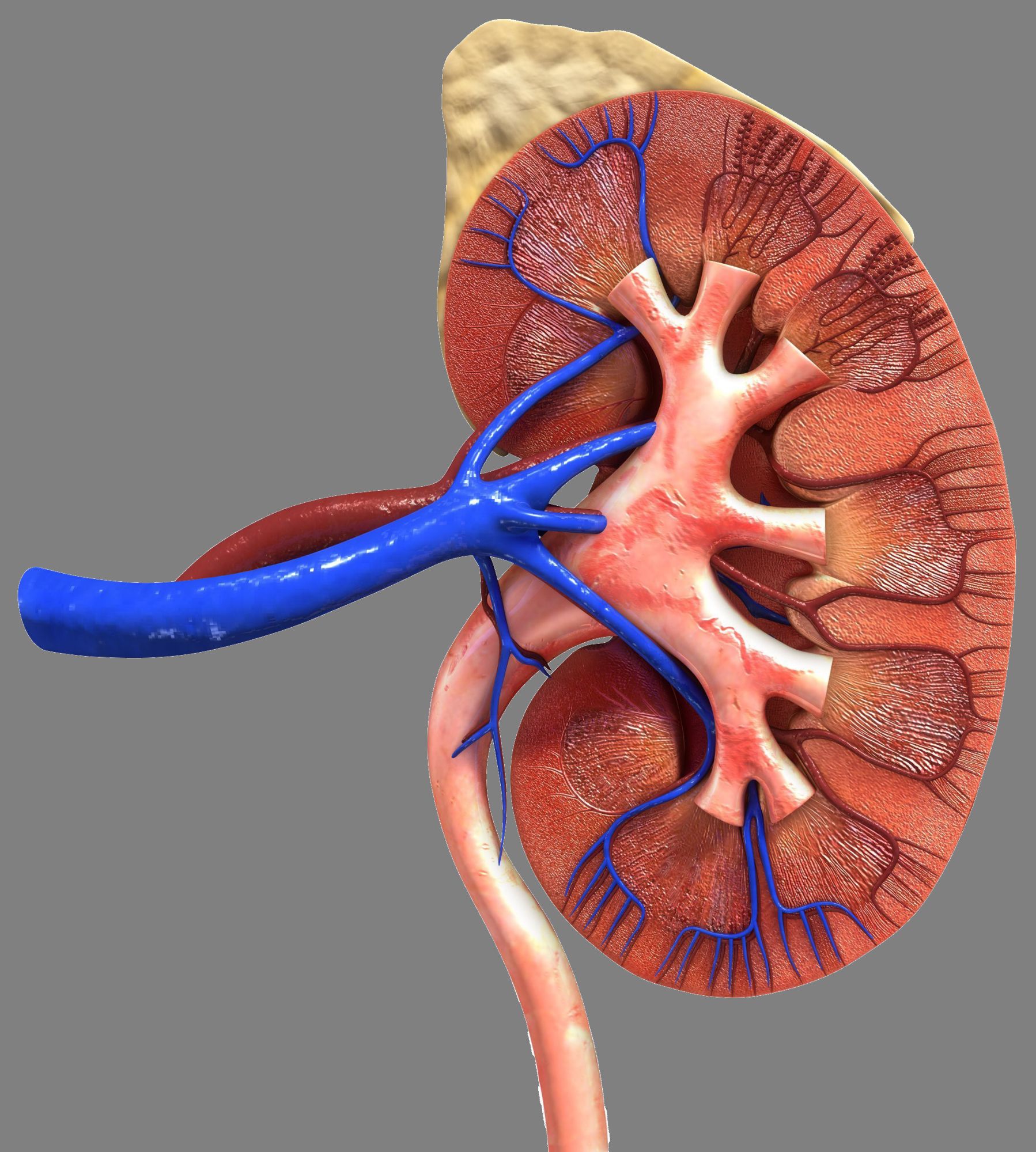 Πέτρες στους νεφρούς: Από την οδύνη στη δράση-1