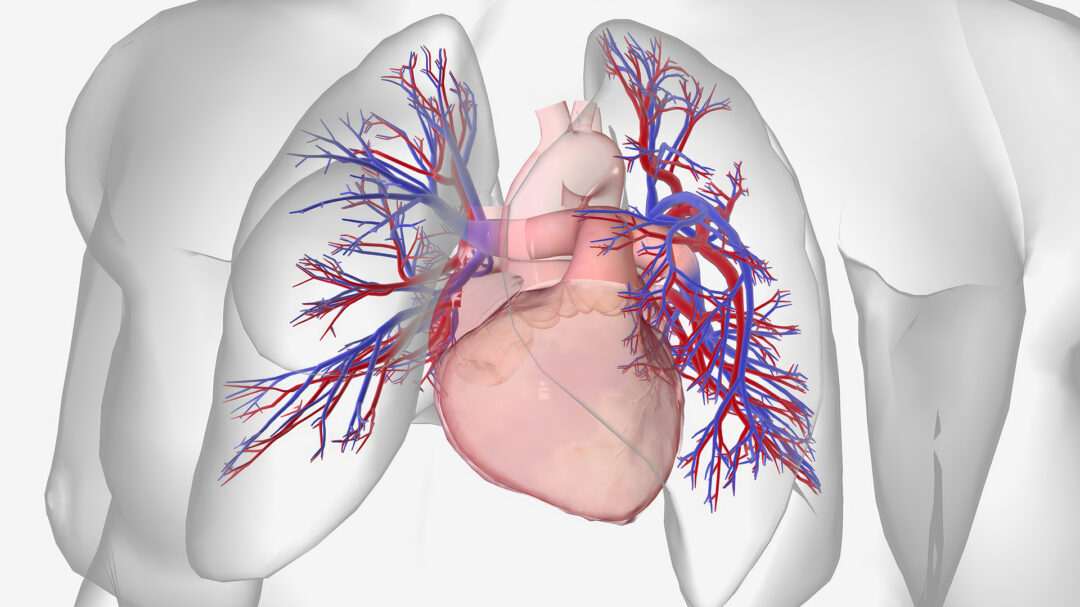 τι-είναι-η-πνευμονική-υπέρταση-563782498