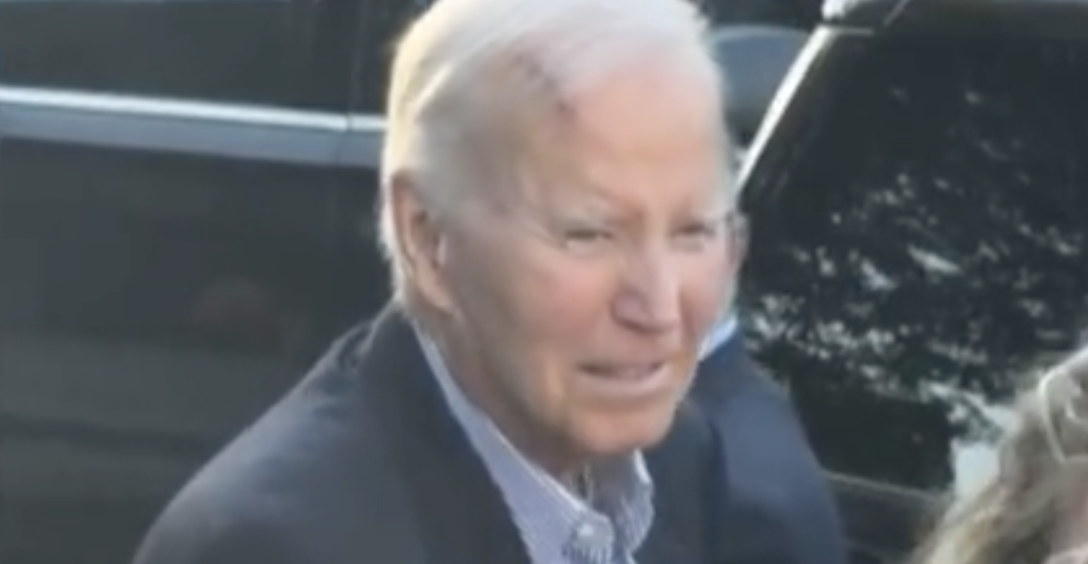 Ο Μπάιντεν υπεβλήθη σε χειρουργική επέμβαση για την αφαίρεση καρκίνων του δέρματος-1