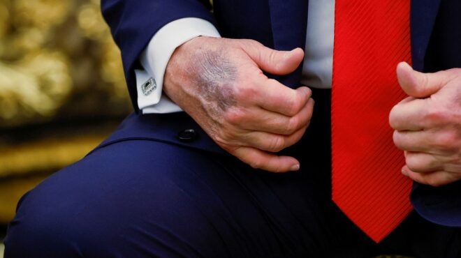 τραμπ-ψεύτικες-οι-φήμες-για-την-υγεί-563792911