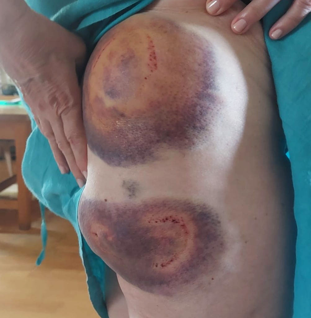 Αντιμέτωποι με τα σαγόνια των χελωνών-2